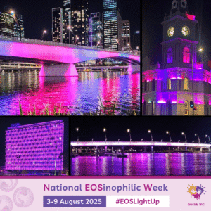 EOSLightUp Campaign
