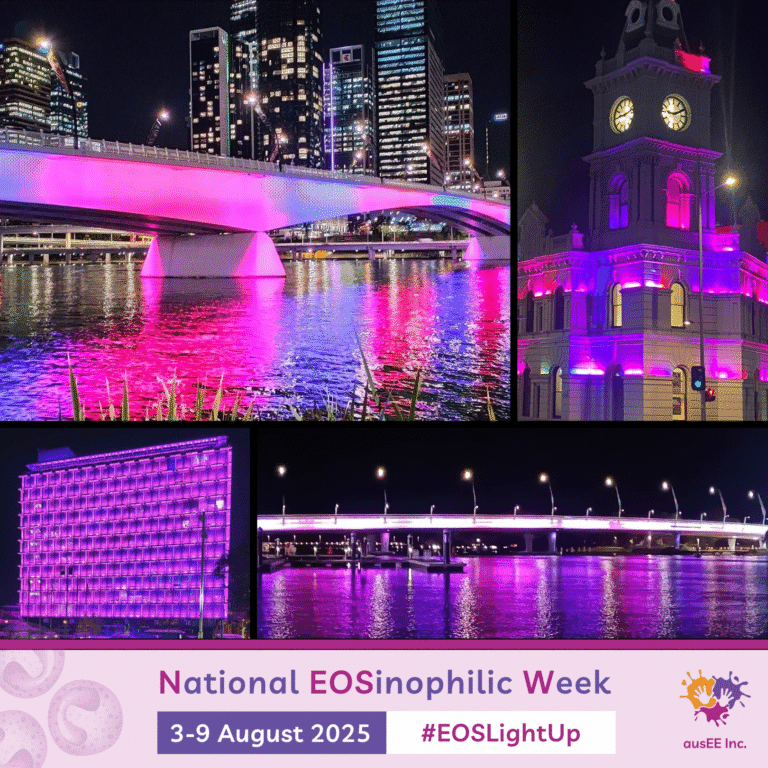 EOSLightUp Campaign